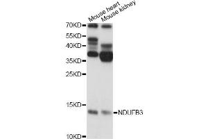 Western blot analysis of extracts of various cell lines, using NDUFB3 antibody. (NDUFB3 anticorps)