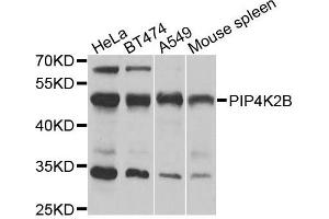 Western blot analysis of extracts of various cells, using PIP4K2B antibody. (PIP4K2B anticorps)