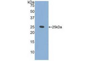 Detection of Recombinant CRADD, Human using Polyclonal Antibody to CASP2 And RIPK1 Domain Containing Adaptor With Death Domain Protein (CRADD) (CRADD anticorps  (AA 1-199))