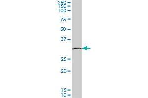 SIX3 monoclonal antibody (M04), clone 1A2. (SIX3 anticorps  (AA 273-332))