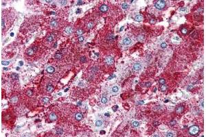 Liver, Human: Formalin-Fixed, Paraffin-Embedded (FFPE)