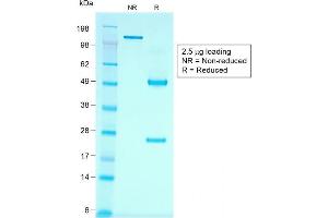 SDS-PAGE Analysis Purified KSP-Cadherin Recombinant Monoclonal Antibody (rCDH16/1071).