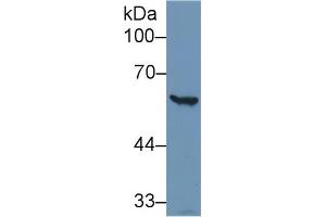 Western Blot; Sample: Human Hela cell lysate; Primary Ab: 1µg/ml Rabbit Anti-Human G6PD Antibody Second Ab: 0. (Glucose-6-Phosphate Dehydrogenase anticorps  (AA 1-515))