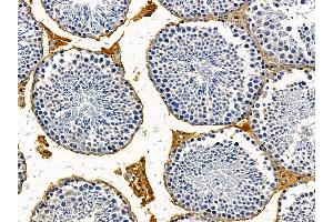 ABIN7095603 and ABIN7099665 at 1/100 staining mouse testis tissue by IHC-P. (ANP32E anticorps)