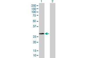 Western Blot analysis of DHRS4 expression in transfected 293T cell line by DHRS4 MaxPab polyclonal antibody. (DHRS4 anticorps  (AA 1-278))