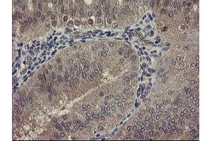 Image no. 3 for anti-rho GTPase Activating Protein 2 (ARHGAP2) antibody (ABIN1499629)