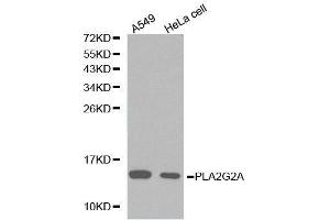 Western Blotting (WB) image for anti-Phospholipase A2, Group IIA (Platelets, Synovial Fluid) (PLA2G2A) (AA 21-144) antibody (ABIN3021802) (PLA2G2A anticorps  (AA 21-144))