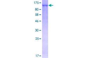Image no. 1 for Tripartite Motif Containing 28 (TRIM28) (AA 1-835) protein (GST tag) (ABIN1323643)