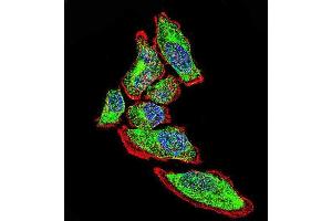 Confocal immunofluorescent analysis of Vimentin Antibody with A549 cell followed by Alexa Fluor 488-conjugated goat anti-rabbit lgG (green).