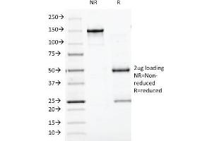 SDS-PAGE Analysis Purified Chromogranin A Monoclonal Antibody (CGA/413). (Chromogranin A anticorps)
