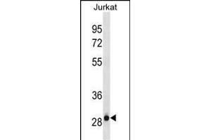 HAGH Antibody (C-term)(Ascites) ABIN1882252 western blot analysis in Jurkat cell line lysates (35 μg/lane). (HAGH anticorps  (C-Term))
