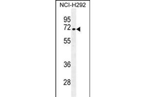 NUMB Antibody (N-term) (ABIN655396 and ABIN2844944) western blot analysis in NCI- cell line lysates (35 μg/lane). (NUMB anticorps  (N-Term))