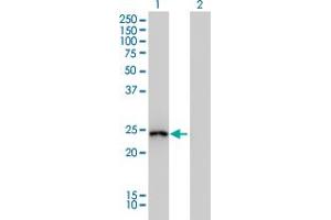 Western Blot analysis of GSTA1 expression in transfected 293T cell line by GSTA1 monoclonal antibody (M01), clone 2F7. (GSTA1 anticorps  (AA 1-222))