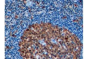 Detection of STMN1 in Human Tonsil Tissue using Polyclonal Antibody to Stathmin 1 (STMN1)