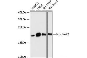 Western blot analysis of extracts of various cell lines using NDUFAF2 Polyclonal Antibody at dilution of 1:3000. (NDUFAF2 anticorps)