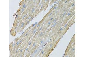 Immunohistochemistry of paraffin-embedded Mouse heart using CKMT2 Polyclonal Antibody at dilution of 1:100 (40x lens). (CKMT2 anticorps)