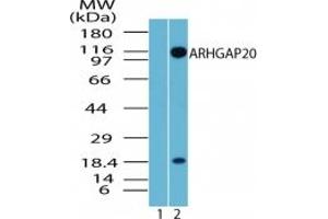 Image no. 3 for anti-rho GTPase Activating Protein 20 (ARHGAP20) (AA 570-620) antibody (ABIN207767)