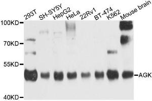Western blot analysis of extracts of various cell lines, using AGK antibody. (Acylglycerol Kinase anticorps  (AA 233-422))