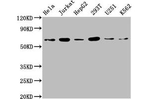 Western Blot Positive WB detected in: Hela whole cell lysate, Jurkat whole cell lysate, HepG2 whole cell lysate, 293T whole cell lysate, U251 whole cell lysate, K562 whole cell lysate All lanes: NUP58 antibody at 1:2000 Secondary Goat polyclonal to rabbit IgG at 1/50000 dilution Predicted band size: 61, 51, 60 kDa Observed band size: 65 kDa (NUPL1 anticorps  (AA 211-480))