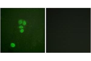 Immunofluorescence analysis of A549 cells, using SOX9 (Ab-181) Antibody.