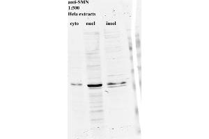 Western blot for SMN on HeLa cell extracts (SMN1 anticorps)