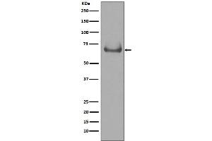 Western blot analysis of Lamin B Receptor expression in Jurkat cell lysate.
