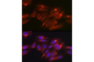 Immunofluorescence analysis of U2OS cells using Raptor Rabbit pAb (ABIN7269901) at dilution of 1:50 (40x lens). (Raptor anticorps)
