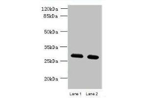 Western blot All lanes: TMEM38B antibody at 1. (TMEM38B anticorps  (AA 249-291))