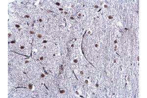 IHC-P Image CBX1 / HP1 beta antibody detects CBX1 / HP1 beta protein at nucleus on mouse middle brain by immunohistochemical analysis. (CBX1 anticorps  (Center))