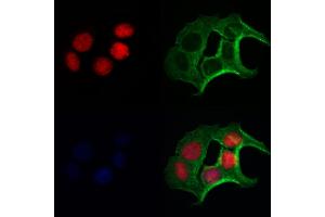 FLCN Antibody staining Hela cells by IF/ICC.