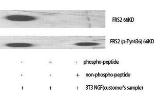 Western Blot (WB) analysis of specific cells using Phospho-FRS2 (Y436) Polyclonal Antibody. (FRS2 anticorps  (pTyr436))