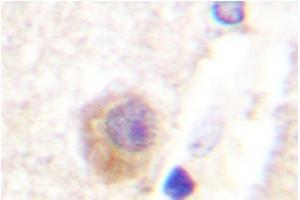 Image no. 2 for anti-Rabphilin 3A (RPH3A) antibody (ABIN272075) (RPH3A anticorps)