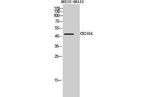 Western Blotting (WB) image for anti-Rh Blood Group, D Antigen (RHD) (Internal Region) antibody (ABIN3181464) (RHD anticorps  (Internal Region))