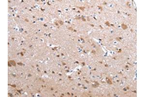 The image on the left is immunohistochemistry of paraffin-embedded Human brain tissue using ABIN7190229(CFC1 Antibody) at dilution 1/20, on the right is treated with synthetic peptide. (CFC1 anticorps)