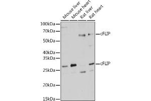 Western blot analysis of extracts of various cell lines, using cFLIP antibody (ABIN3016246, ABIN3016247, ABIN3016248 and ABIN6219655) at 1:1000 dilution. (FLIP anticorps  (AA 161-480))