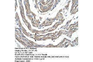 Rabbit Anti-STK11 Antibody  Paraffin Embedded Tissue: Human Muscle Cellular Data: Skeletal muscle cells Antibody Concentration: 4. (LKB1 anticorps  (N-Term))