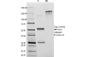 SDS-PAGE Analysis Purified CD31 Mouse Monoclonal Antibody (C31.