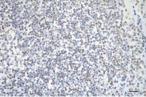 Immunohistochemistry was performed on paraffin-embedded human tonsillitis using AKAP8 antibody (ABIN7797435), 1:200).