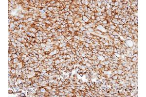 IHC-P Image Immunohistochemical analysis of paraffin-embedded H1299 xenograft, using GRK3, antibody at 1:100 dilution.