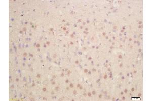 Formalin-fixed and paraffin embedded rat brain labeled with Anti-HES1 Polyclonal Antibody, Unconjugated  at 1:200 followed by conjugation to the secondary antibody and DAB staining (HES1 anticorps  (AA 41-150))