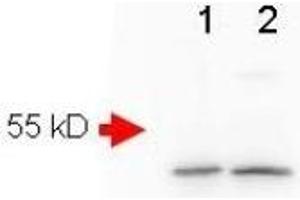 Image no. 3 for anti-Amyloid beta (Abeta) (AA 1-14), (N-Term) antibody (ABIN401205)