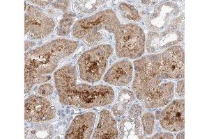 ABIN6266785 at 1/100 staining human kidney tissue sections by IHC-P. (TUBGCP3 anticorps  (N-Term))