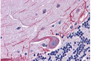 Human Brain, Cerebellum: Formalin-Fixed, Paraffin-Embedded (FFPE) (SKA1 anticorps  (C-Term))