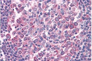 ABIN571054 (µg/ml) staining of paraffin embedded Human Tonsil.