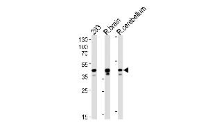 Rat Csnk2a1 Antibody (N-term) (ABIN1881717 and ABIN2843635) western blot analysis in 293 cell line , rat brain and cerebellum tissue lysates (35 μg/lane). (CSNK2A1/CK II alpha anticorps  (N-Term))