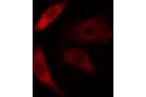 ABIN6274618 staining COLO205 cells by IF/ICC. (CDKAL1 anticorps  (N-Term))