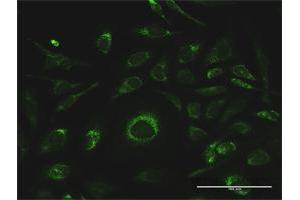 Immunofluorescence of purified MaxPab antibody to GSTK1 on HeLa cell.