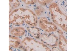 Used in DAB staining on fromalin fixed paraffin- embedded kidney tissue