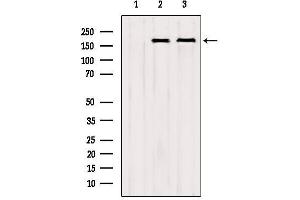 Western blot analysis of extracts from various samples, using CNOT1 Antibody. (CNOT1 anticorps  (Internal Region))