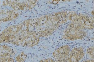 ABIN6274623 at 1/100 staining Human uterus tissue by IHC-P.